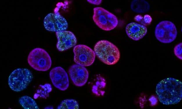 Cancer Naming, Grading and Staging
