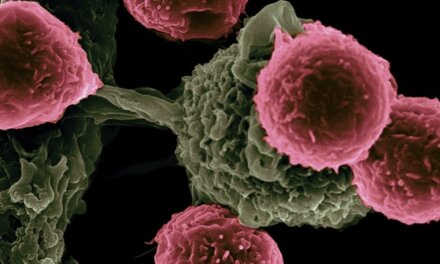 The Body Defense Structure: Immune System 101
