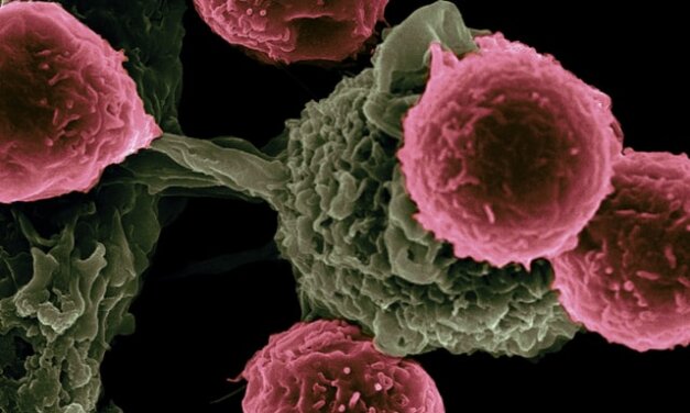 The Body Defense Structure: Immune System 101